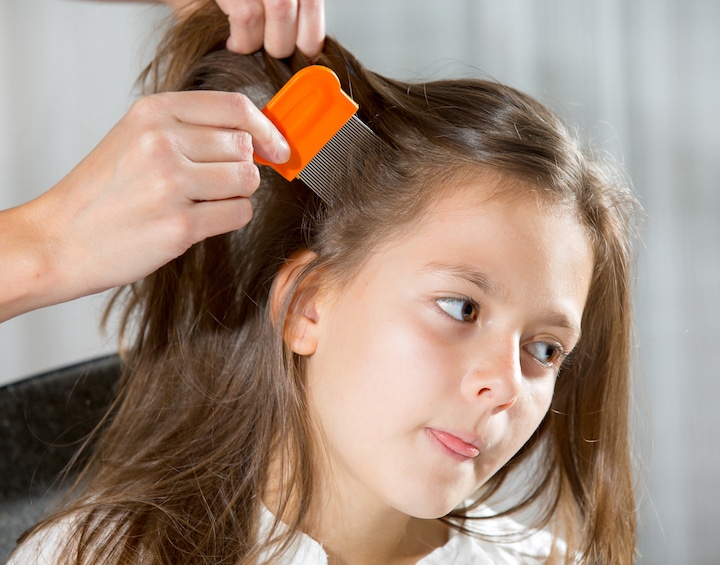 treating girl with head lice