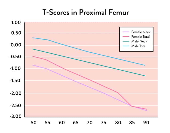 Bone Density T-Score Chart