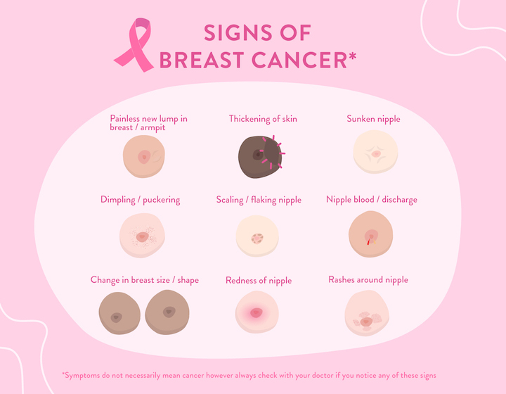 SYOK ENG - Breast cancer is the most common form of cancer