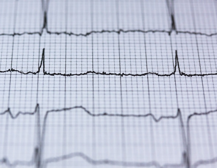 Heart rate monitor chart health check Hong Kong